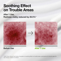 Azelaic Acid CICA Skin Soothing Moisturizer